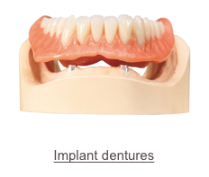￼
Implant dentures